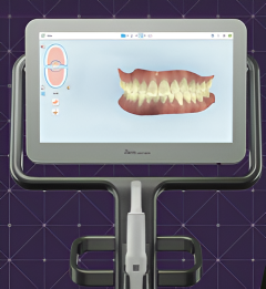 Itero scan of the teeth